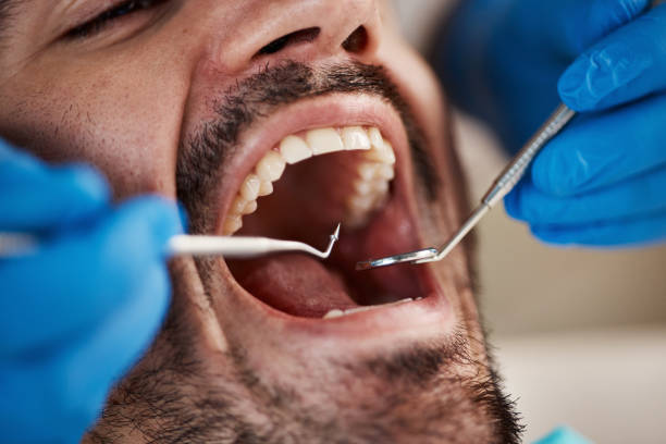Best Same-Day Emergency Dentist in Stinnett, TX