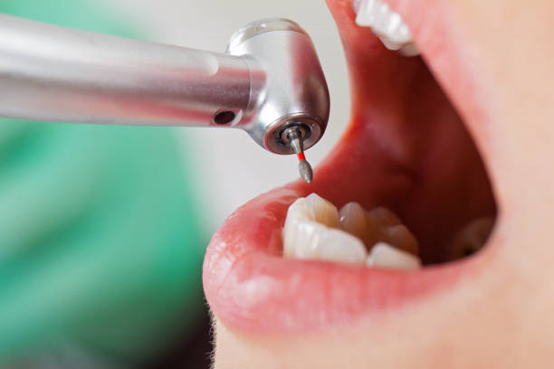 Best Emergency Dental Surgery in Stinnett, TX